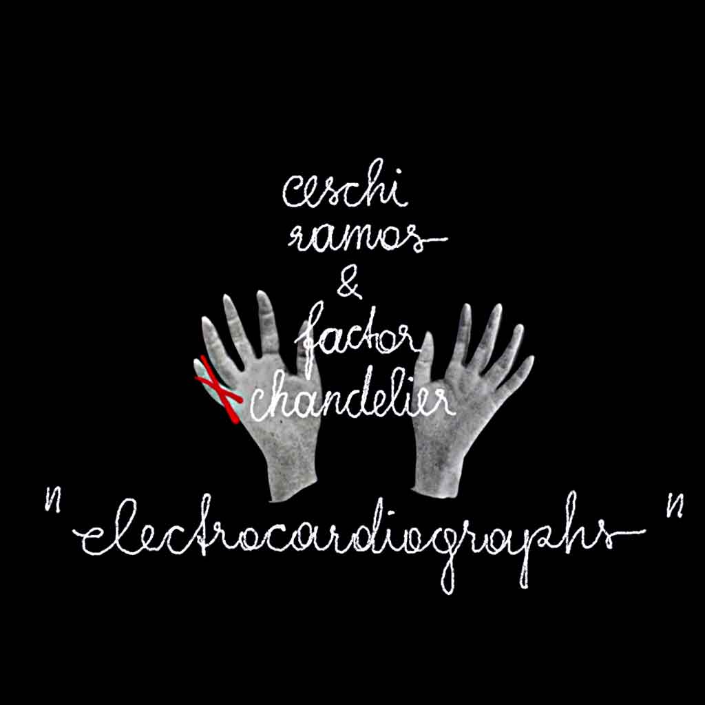 electrocadiographs-by-ceschi-and-factor-chanelier